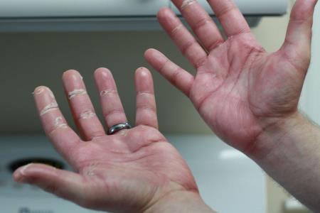Kako na rokah prepoznati raka